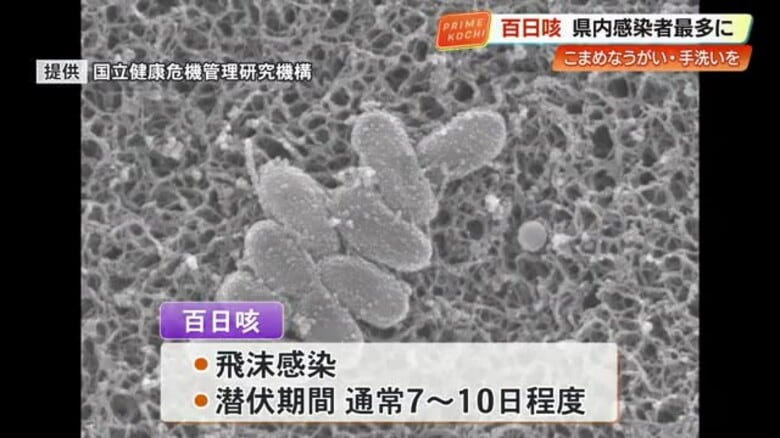 百日咳の感染者　過去最多196人　【高知県】予防心がけ、ワクチン接種も検討を｜FNNプライムオンライン