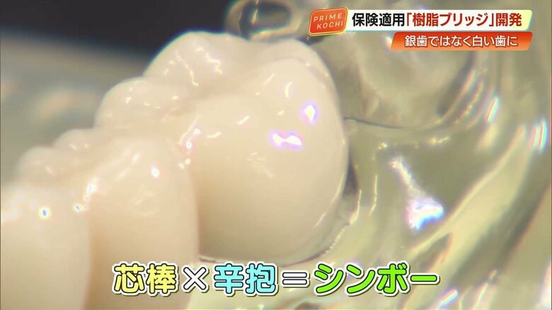 「シンボー」の由来