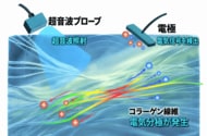 超音波で骨粗鬆症による骨の質的変化を検出