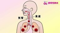 高齢者肺炎の7割を占める誤嚥性肺炎　パタカラ体操で“食べる力”を強化　早期発見は周囲の“気付き”がポイントに