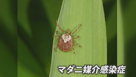 「ちょっと変やな」から診断まで1週間　マダニ媒介感染症に注意　致死率10～30％のSFTSが全国的に増加傾向