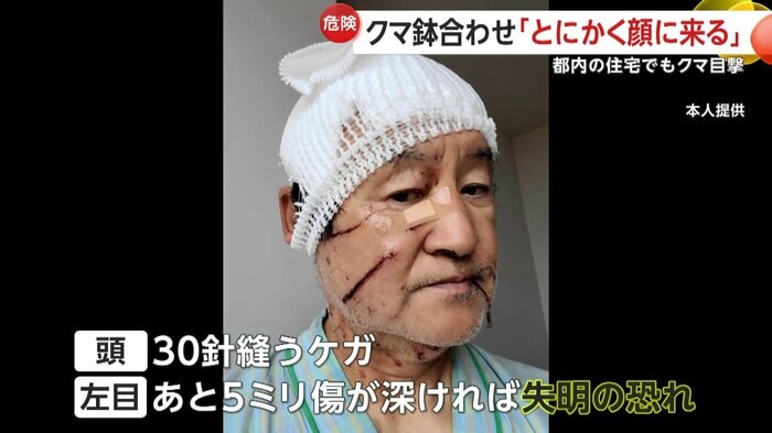 2年前にクマに襲われた湊屋啓二さん:本人提供