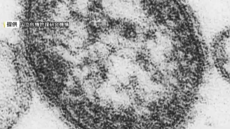 福岡県内で今年初「はしか」感染確認　久留米市の40代で海外渡航歴あり　インフルエンザ警報は14週連続｜FNNプライムオンライン