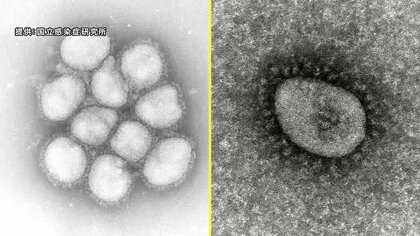 新型コロナ＆インフル“同時流行”に注意　併発で重症化のおそれも【岩手発】