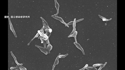 マイコプラズマ肺炎の全国患者数が2週連続で過去最多「今後さらに感染広がる可能性」　長引くせきや発熱が特徴　厚生労働省