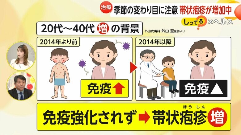 子どもへの水ぼうそうワクチンの定期接種が理由で増加する大人の帯状疱疹