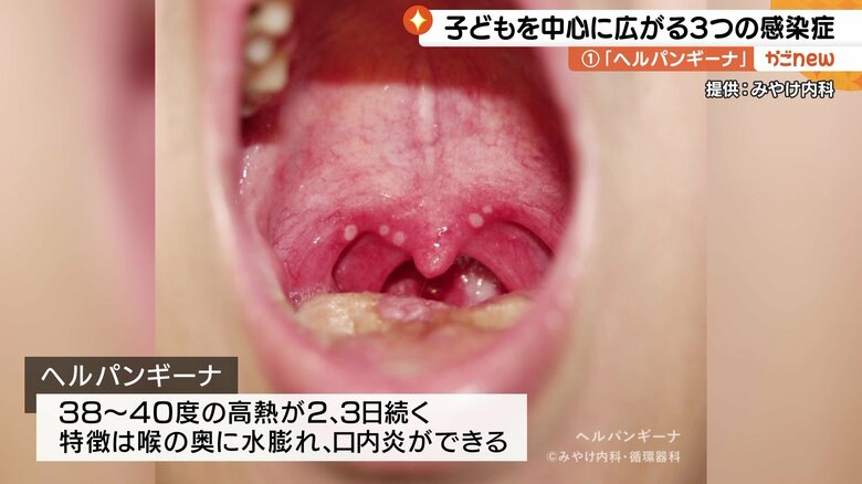 画像提供：みやけ内科・循環器科