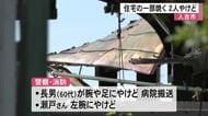 人吉市で住宅の一部を焼く住人の２人やけど【熊本】