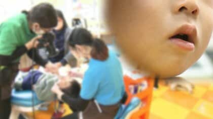 子供の3割超が“お口ぽかん”状態　発育に悪影響のおそれも　マスク生活も一因か【静岡発】