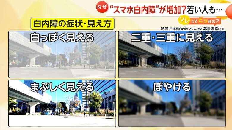 「白っぽく見える」「ぼやける」など白内障の症状や見え方