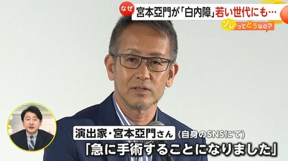 若い世代で“スマホ白内障”増加 …“急激に進行”失明の危険性も　予防に「こすらないことが大切」　宮本亞門氏が「白内障手術」公表【ソレってどうなの？】