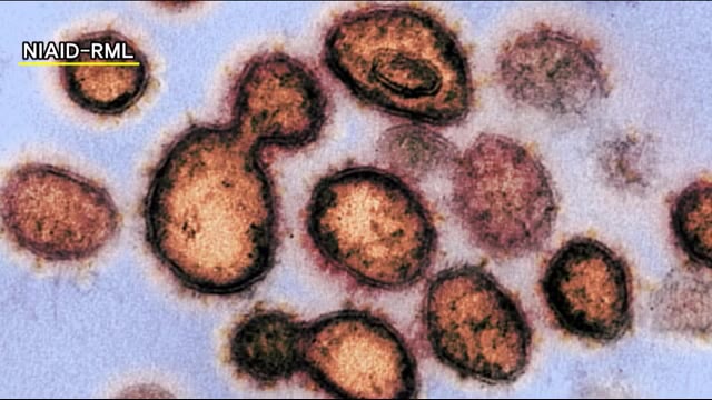 新型コロナ 福島県で3人の感染を確認(9月19日)