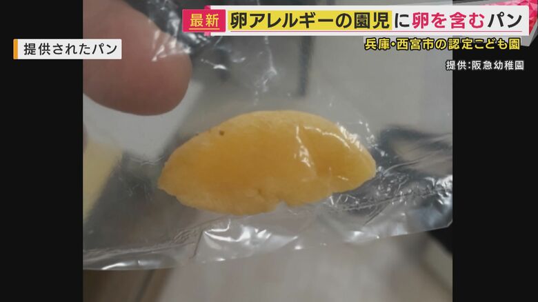 「泣きながら、かゆいかゆいって」卵アレルギーのある園児に卵含むパン アナフィラキシーの症状で病院搬送｜FNNプライムオンライン