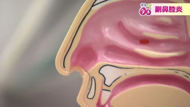 鼻うがいも有効
