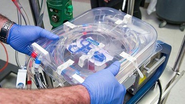 体外式膜型人工肺(ECMO)機械市場「予測期間中に4.5%のCAGRで成長すると予想」ー世界の業界分析、傾向、市場規模、および予測2025年
