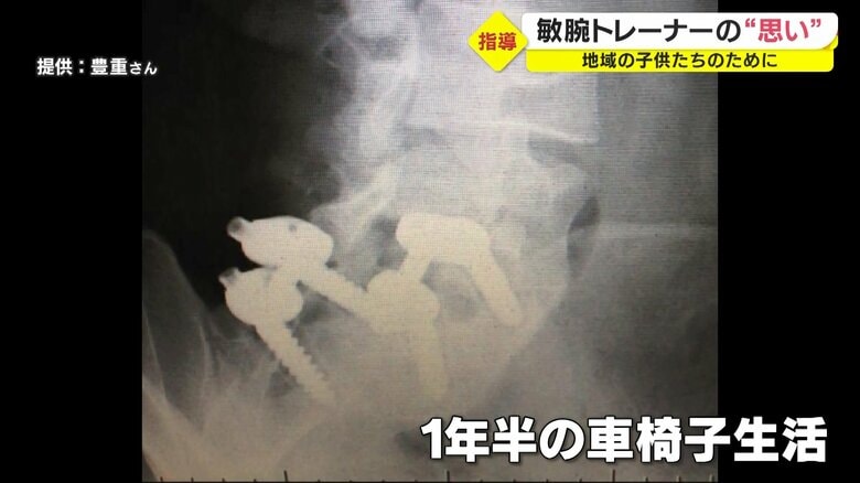 腰の骨を折る大けがを負った豊重さん