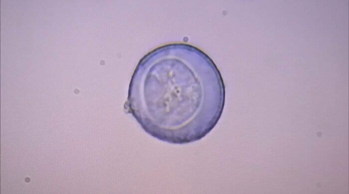 顕微鏡で確認した青く反応したスギ花粉