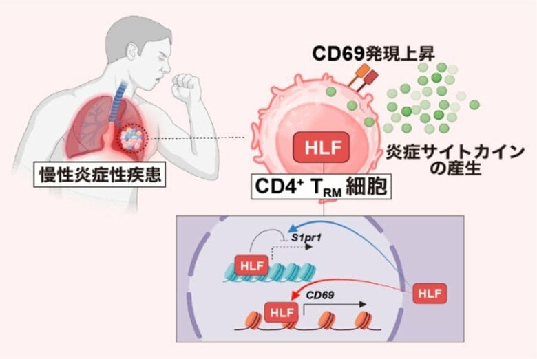 慢性炎症の原因となるタンパク質を新たに特定～ぜんそくなどの慢性炎症性疾患の新たな治療法開発に期待～