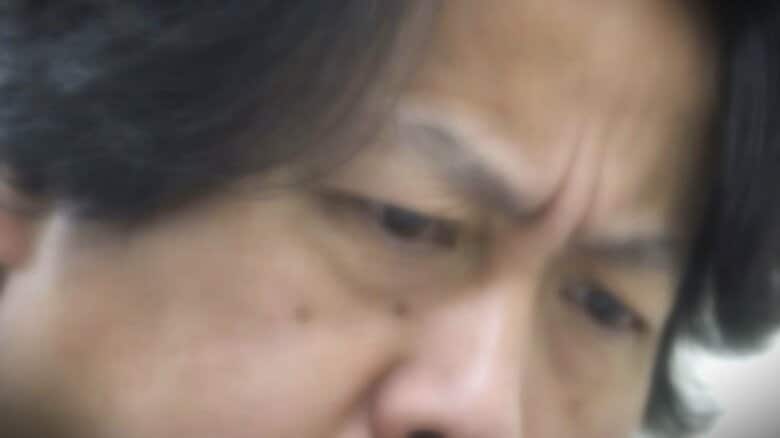 「完治は難しい」視野がゆがむ、欠けて見える…加齢黄斑変性かも 50歳以上の100人に1人が発症 予防策やチェック方法を専門医に聞く|FNNプライムオンライン