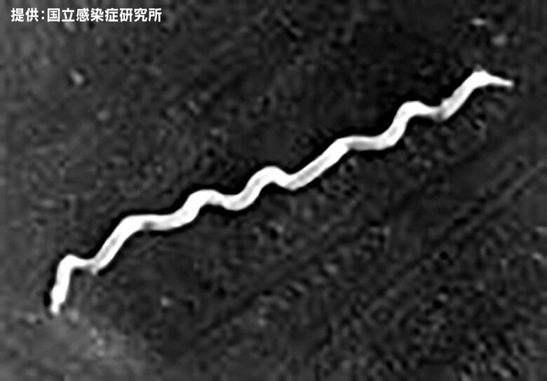 病原体の「梅毒トレポネーマ」電子顕微鏡像（ネガティブ染色）提供：国立感染症研究所