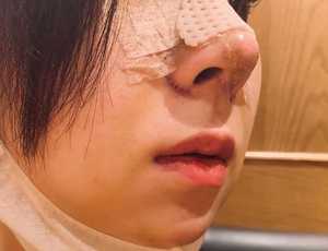 “韓流整形ブーム”に沸く日本人女性 トラブルも続出!?