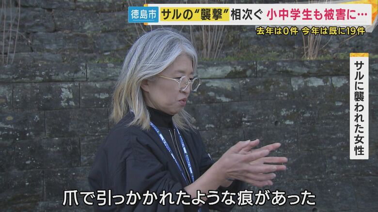 サルの被害にあった女性