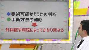 もし検査でポリープが見つかったら… 「胆のうがん」病院選びのポイントは