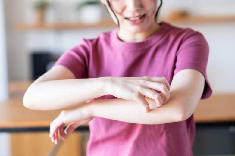 こじらせると「結節性痒疹」になることも（画像はイメージ）