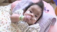 1歳までの生存率約10％　18トリソミーの女の子　家族の支えの中、1歳迎える「1日1日が小さな奇跡。家族と一緒に1日でも1分1秒でも長く」【大分発】