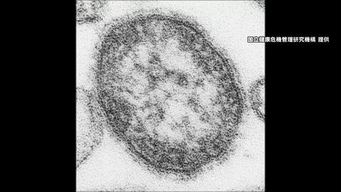 「はしか」の感染者数増　上野厚労大臣「ワクチン接種検討を」