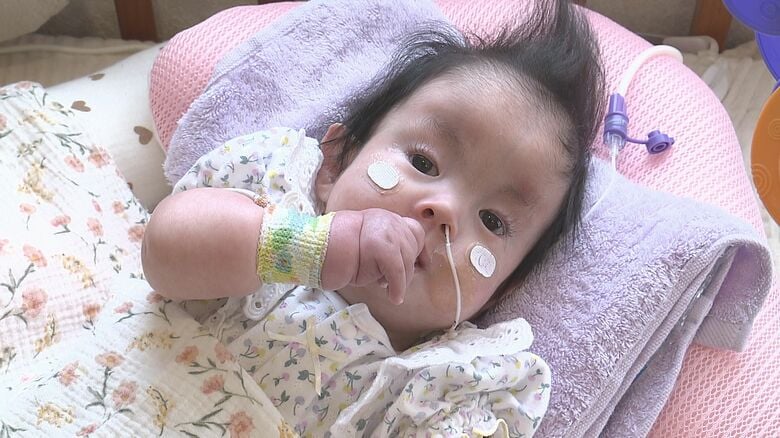 1歳までの生存率約10％　18トリソミーの女の子　家族の支えの中、1歳迎える「1日1日が小さな奇跡。家族と一緒に1日でも1分1秒でも長く」【大分発】｜FNNプライムオンライン