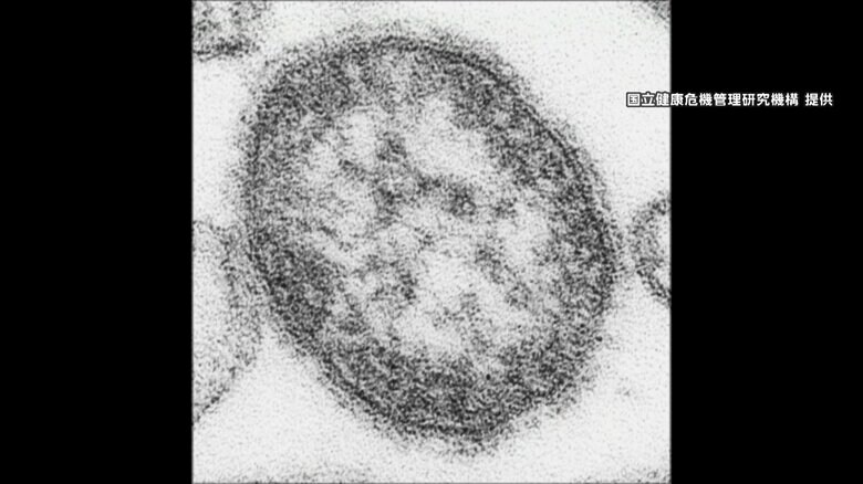 都道府県別では東京都だけで211人　「はしか」感染者数が436人と最多に迫る勢い　感染場所は「国内」が7割｜FNNプライムオンライン