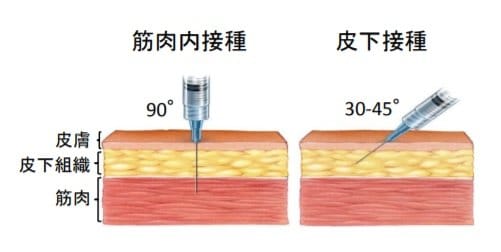 「皮下注射」と「筋肉注射」の比較(出典:日本小児科学会)