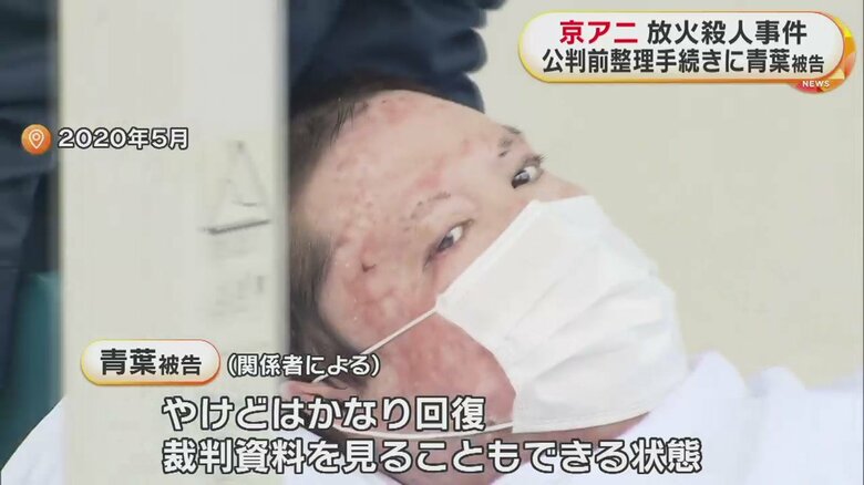 事件後の青葉被告。自身も重いやけどを負っていた