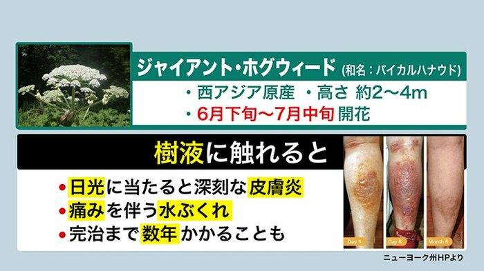 樹液に触れ日光に当たると、激しい皮膚炎などを引き起こす