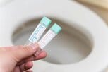 「おならが臭い」は大腸がんと関係ある？便が“細い・黒い”は要注意！赤身肉や加工肉への留意と「検便」による早期発見