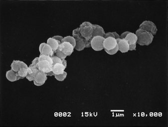 生命の起源 は他の星から来たかも 宇宙空間で 3年生きる細菌 を発見