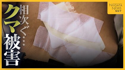 【クマ被害】自宅敷地内で男性が襲われ恐怖語る「九死に一生を得た…」 越後湯沢駅近くの温泉街でも宿泊客が被害