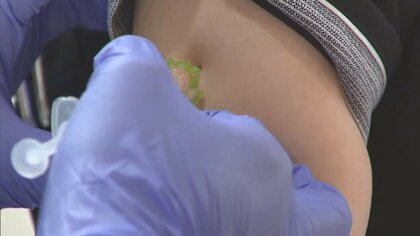 日本でも5～11歳のワクチン接種を承認 子育て中の医師に接種の判断のポイントを聞いた