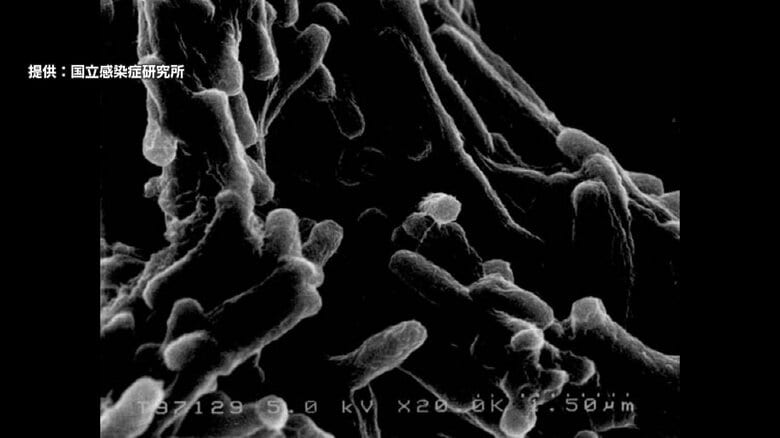 「感染」と「発病」の違いは？静岡市で10年ぶりに結核の集団感染を確認　治療を受けないと約5割が死亡　かつては“国民病”とおそれられ現在も年間1万人以上が発症｜FNNプライムオンライン
