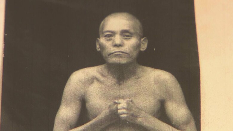 全国初　ハンセン病元患者の“解剖録”を公開　生きた証を伝え偏見差別をなくす【岡山発】｜FNNプライムオンライン