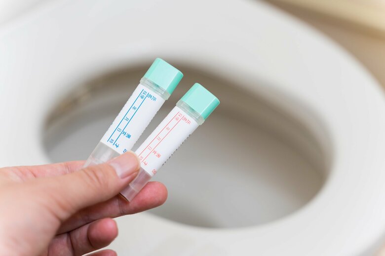 「おならが臭い」は大腸がんと関係ある？便が“細い・黒い”は要注意！赤身肉や加工肉への留意と「検便」による早期発見｜FNNプライムオンライン