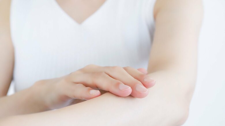 肌トラブルを招く恐れも（画像はイメージ）