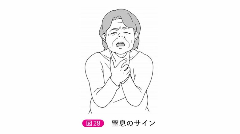 「窒息のサイン」（「改定6版　救急蘇生法の指針2020（市民用）」より）