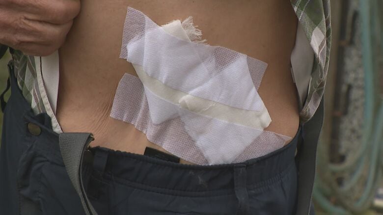 クマに襲われた男性（新発田市）