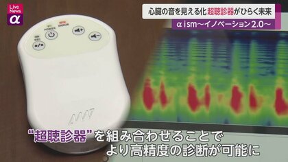 心臓の音を“見える化”　｢超聴診器｣がひらく未来