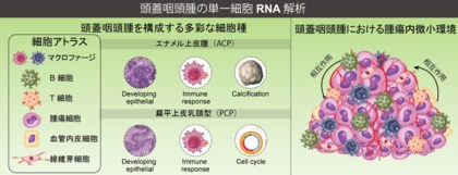 頭蓋咽頭腫における腫瘍微小環境と免疫ネットワークの分子機序の解明 ~頭蓋咽頭腫の新たな治療法にむけて~