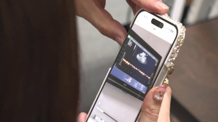 2人が見つめるエコー動画