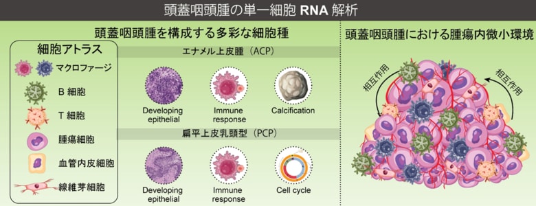 頭蓋咽頭腫における腫瘍微小環境と免疫ネットワークの分子機序の解明 ~頭蓋咽頭腫の新たな治療法にむけて~