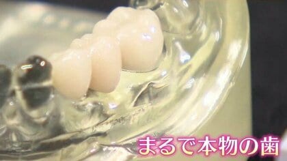 ◆銀歯の悩みとお別れ！保険適用の樹脂製ブリッジ　◆歯の詰め物の水銀リスクとメタルフリー治療　◆見逃しがちな大人の虫歯と歯磨き術